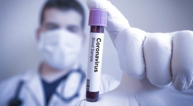 Coronavirus 31