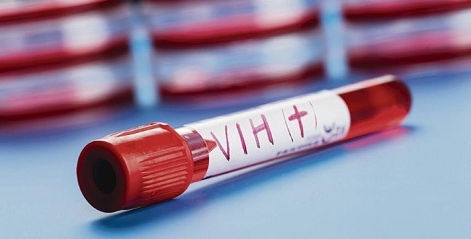 Lotta all’AIDS: le iniziative nella settimana del 1° dicembre a Reggio Emilia
